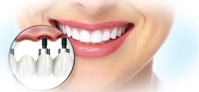 Виды услуг косметической стоматологии