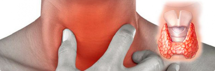 Щитовидка симптомы, что нужно знать
