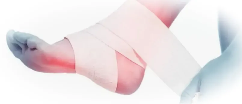 фиксация голеностопа