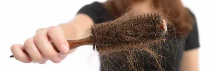 Выпадение волос: причины и лечение