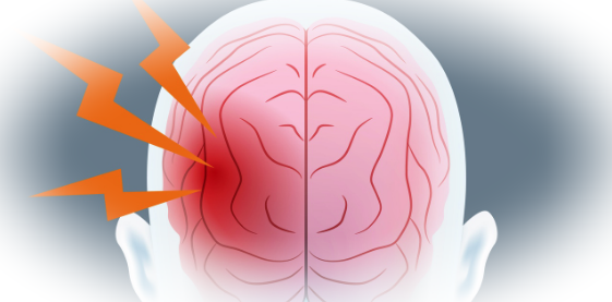 Чем опасен инсульт, как его распознать и лечить