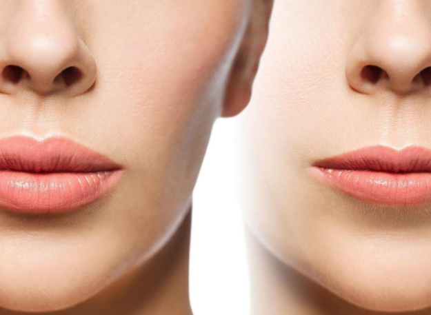 Как самостоятельно эффективно и безопасно увеличить губы?
