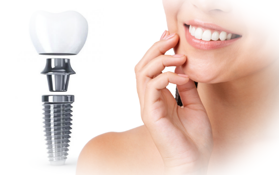 Имплантация зубов - динамично развивающаяся отрасль современной стоматологии