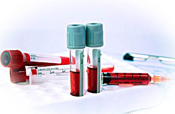 Анализ крови на АСЛ-О: как готовиться и для чего проводится