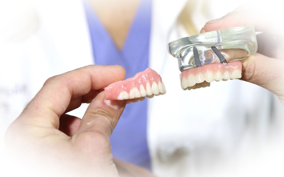 Современное протезирование на зубах: особенности и разновидности конструкций