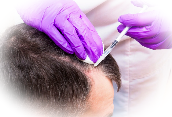 Пересадка волос: описание, особенности, методики