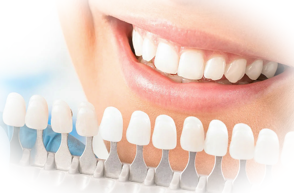 Косметическое отбеливание зубов: вся правда о последствиях