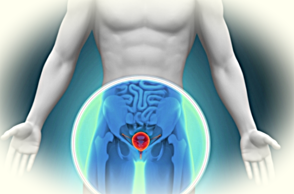 Бактериальный простатит