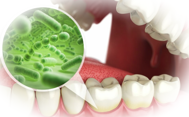 Зубной налет: советы, как легко от него избавиться