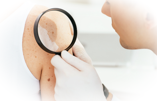 Проблемы с кожей: важность обращения к дерматологу