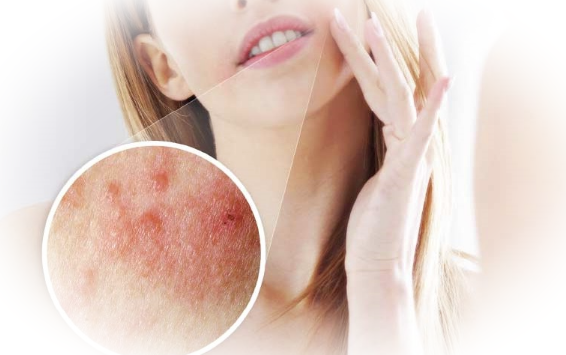 Воспаленная кожа – причины и уход