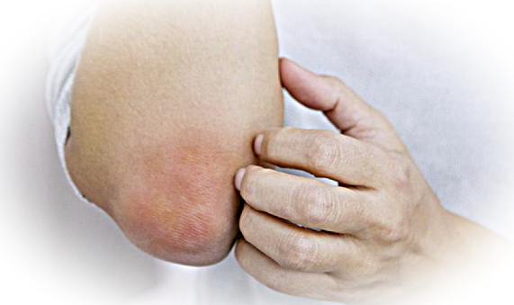 Частые кожные проблемы и способы их устранения