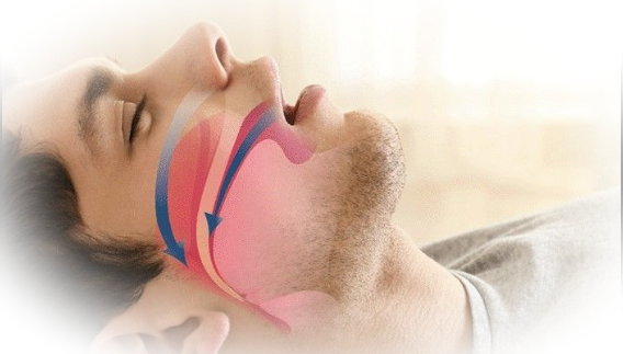 Храп: причины и последствия