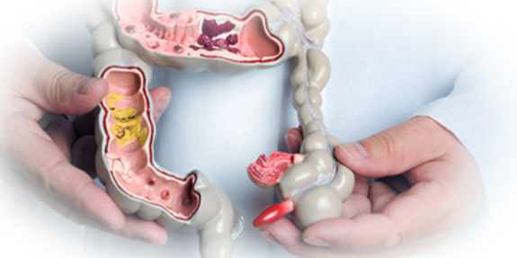 Геморрой после родов: причины, симптомы и лечение