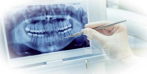 Как и для чего делают 3D компьютерную томографию зубов?