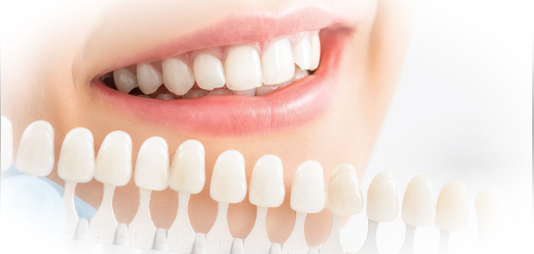 Что представляют собой виниры на зубы?