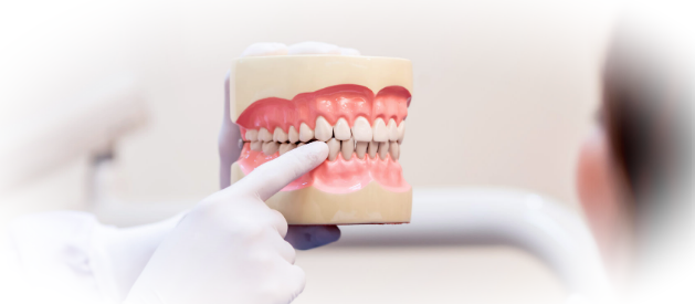 Высокотехнологичная имплантация: зубные протезы по принципу «All-On-4/6»