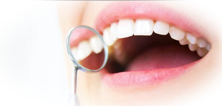 Что такое наращивание зубов и в каких случаях проводится?