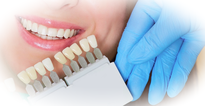 Мифы и реальность о методах осветления зубов