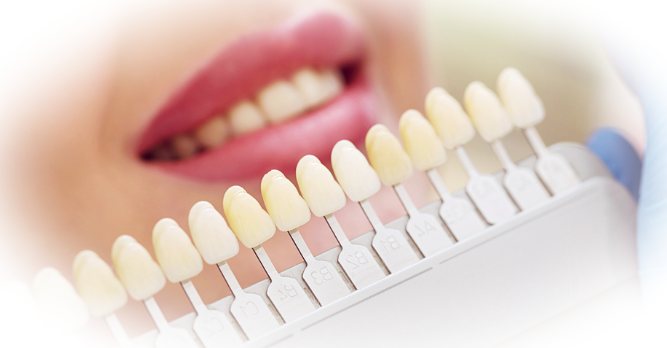 Основные недостатки отбеливания зубной эмали