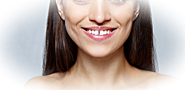 Как образуются щели между зубами?