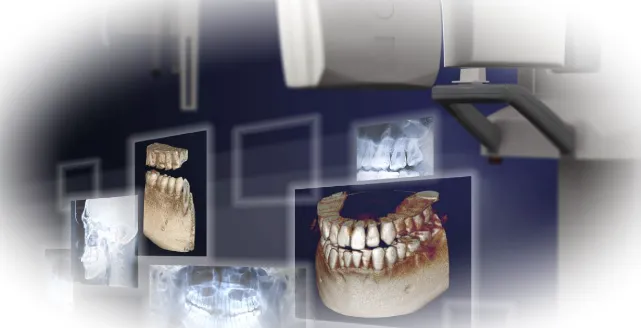Как 3D-визуализация зубов может улучшить состояние полости рта?