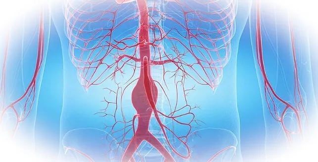 Ранние признаки и симптомы аневризмы аорты - на что обратить внимание