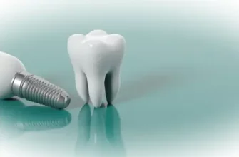 Имплантация зубов под ключ: быстрый путь к идеальной улыбке