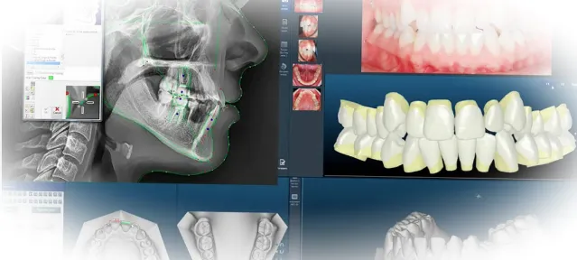 Перспективы развития ортодонтии