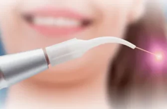 Лазер в стоматологии: безопасность и эстетика