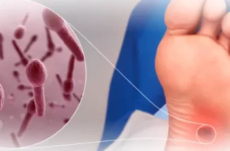 Как определить столбняк и избежать инфекции?