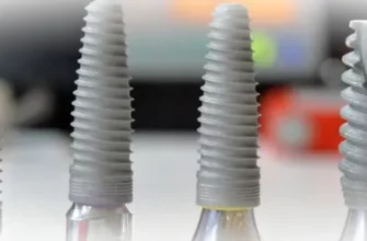 Какую имплантацию выбрать - сразу после удаления или классический вариант?