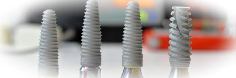 Какую имплантацию выбрать - сразу после удаления или классический вариант?