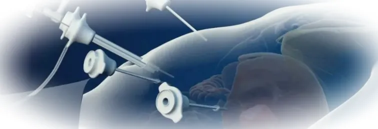  Лапароскопия