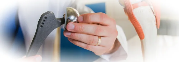 Протезирование суставов: когда необходимо, виды протезов