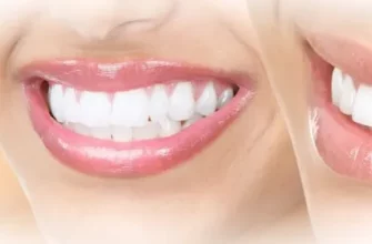 Секрет ровных зубов