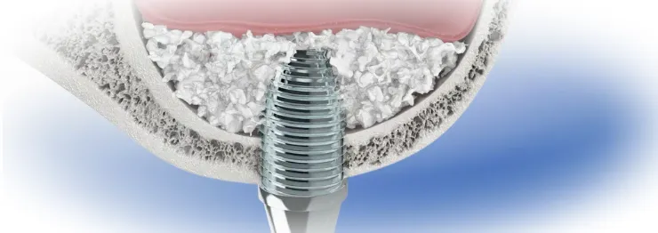 Особенности проведения операции