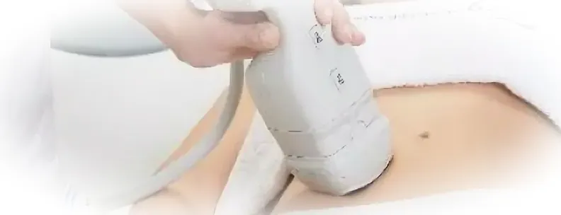 HIFU и Интимные проблемы