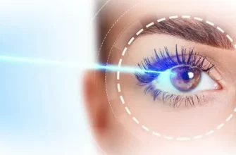 Как делается лазерная коррекция зрения методом Femto Super LASIK