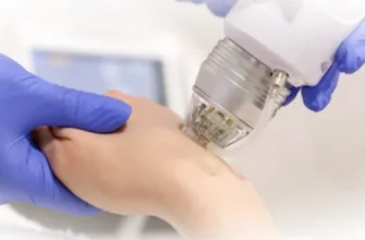 RF-лифтинг кистей рук: современная технология омоложения кожи