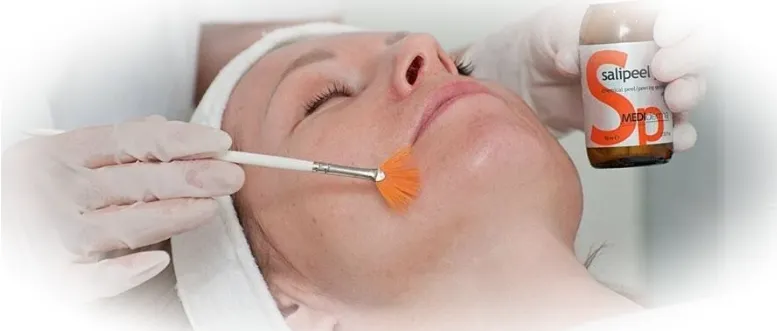 Пилинг с салициловой кислотой