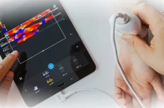 Портативные УЗИ-датчики для смартфона: новая эра в медицинской диагностике