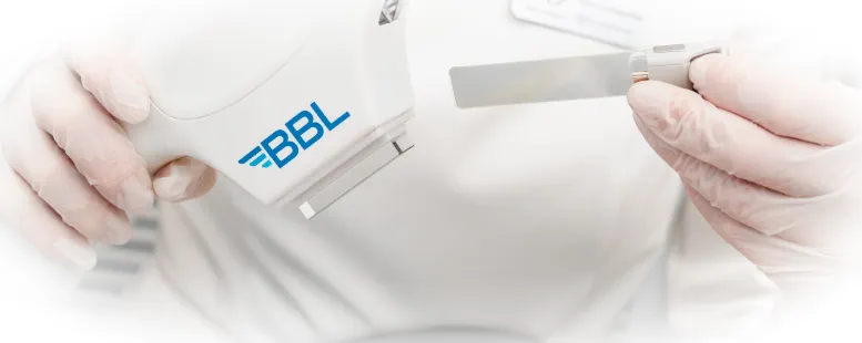 Терапия акне с помощью BBL Forever Clear