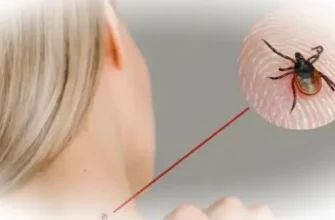 Укусы клещей: Чем опасны и как уберечься?