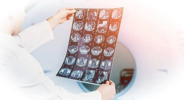 Расшифровка мрт