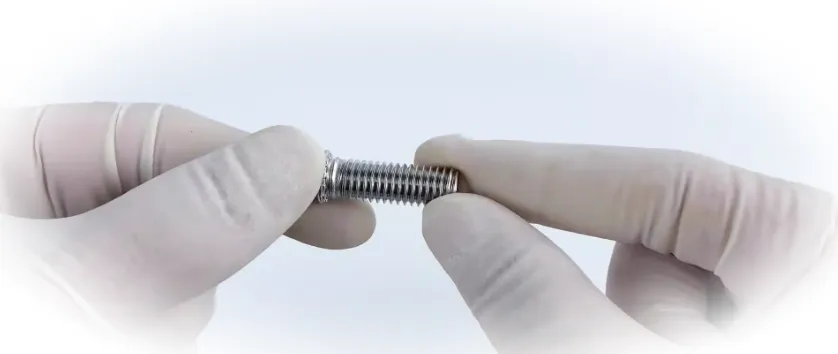 виды имплантации