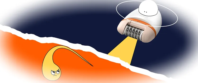 Как предотвратить появление вросших волос