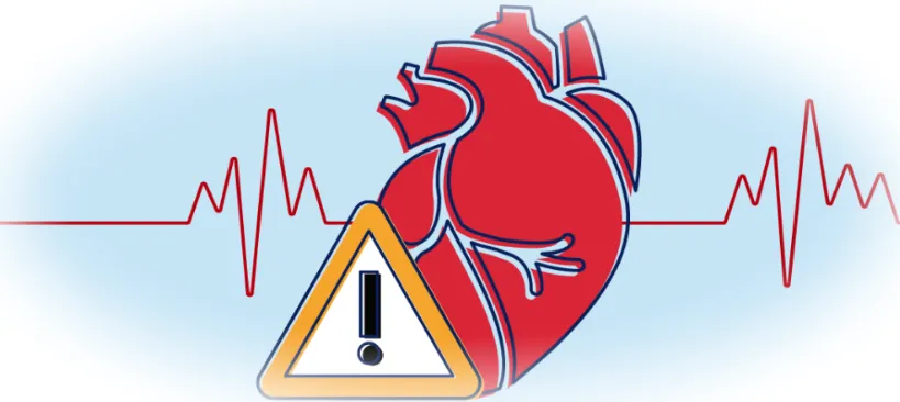 Классификация ИБС