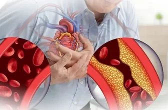 Опасный враг — ишемическая болезнь сердца и её симптомы