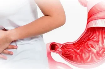 Гастрит: причины, симптомы и современные методы лечения